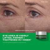 Murad Retinal ReSculpt Eye Treatment 15ml — Retinal para el Contorno — DermaPharma
