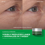 Murad Retinal ReSculpt Eye Treatment 15ml — Retinal para el Contorno — DermaPharma