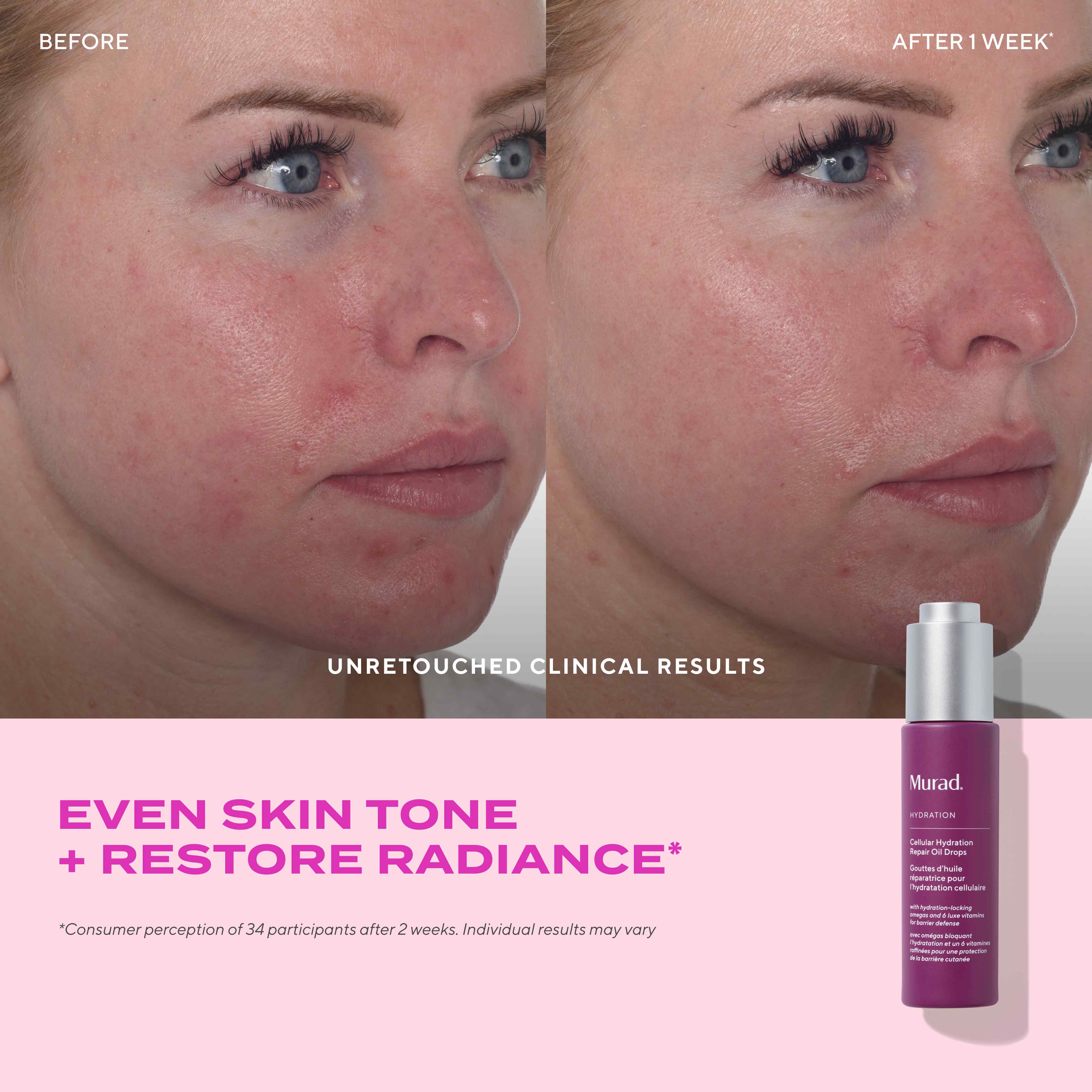 Murad Cellular Hydration Repair Oil Drops 30ml — Gotas Reparadoras — DermaPharma