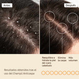Nuggela & Sulé Champú Anticaspa 250 ml con Piroctona Olamina y Extracto de Cebolla Roja (4)